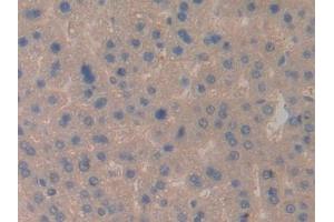 Detection of CCL6 in Rat Liver Tissue using Polyclonal Antibody to Chemokine (C-C motif) ligand 6 (CCL6)