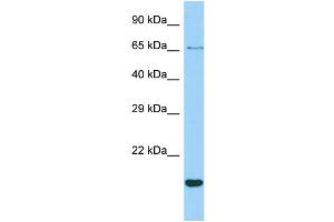 Host: Rabbit Target Name: CR1L Sample Type: ACHN Whole cell lysates Antibody Dilution: 1. (CR1L anticorps  (N-Term))