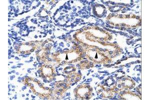 anti-Meis Homeobox 2 (MEIS2) (AA 50-99) antibody