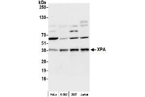 Western Blotting (WB) image for anti-Xeroderma Pigmentosum, Complementation Group A (XPA) (AA 1-50) antibody (ABIN7454782)