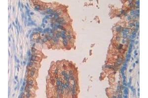 Detection of SEPT5 in Human Prostate Tissue using Polyclonal Antibody to Septin 5 (SEPT5)