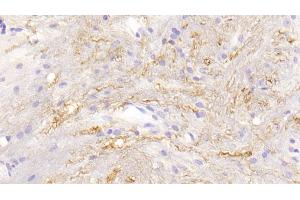 Detection of CTSG in Mouse Spinal cord Tissue using Polyclonal Antibody to Cathepsin G (CTSG)