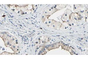 ABIN6277728 at 1/100 staining Human prostate tissue by IHC-P.