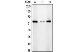 Western blot analysis of CDYL2 expression in A431 (A), HepG2 (B), HeLa (C) whole cell lysates.