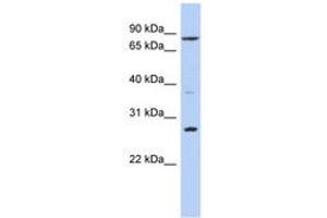 Image no. 1 for anti-Kruppel-Like Factor 12 (KLF12) (AA 51-100) antibody (ABIN6742325) (KLF12 anticorps  (AA 51-100))
