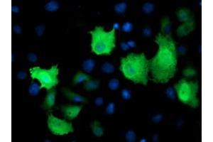 Anti-TMOD1 mouse monoclonal antibody (ABIN2454776) immunofluorescent staining of COS7 cells transiently transfected by pCMV6-ENTRY TMOD1 (RC201134). (Tropomodulin 1 anticorps)
