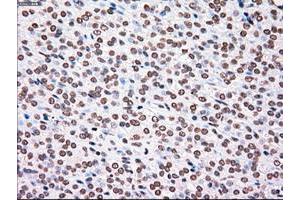 Image no. 8 for anti-Polo-Like Kinase 1 (PLK1) antibody (ABIN1500282)