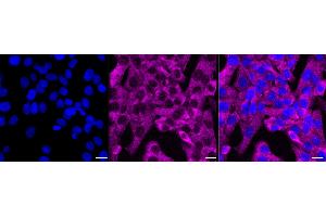 Immunocytochemical staining of HT- cells with C-X-C motif chemokine receptor 5 antibody (ABIN7798047), 1:1,000).