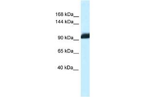 WB Suggested Anti-Zhx1 Antibody   Titration: 1. (ZHX1 anticorps  (C-Term))