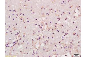 Formalin-fixed and paraffin embedded rat brain labeled with Anti-Glypican 6 Polyclonal Antibody, Unconjugated (ABIN678368) at 1:200 followed by conjugation to the secondary antibody and DAB staining (Glypican 6 anticorps  (AA 351-450))