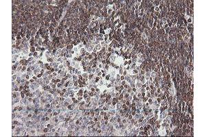 Image no. 2 for anti-Differentially Expressed in FDCP 6 Homolog (DEF6) antibody (ABIN1497809) (DEF6 anticorps)