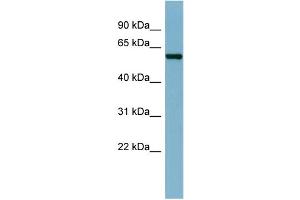 WB Suggested Anti-CAP1  Antibody Titration: 0. (CAP1 anticorps  (N-Term))
