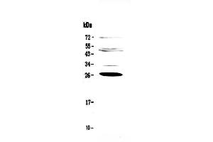 Western blot analysis of Factor D using anti-Factor D antibody . (Adipsin anticorps  (AA 26-253))