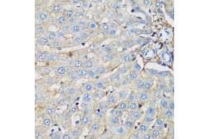 Immunohistochemistry of paraffin-embedded rat liver using PROCR antibody.