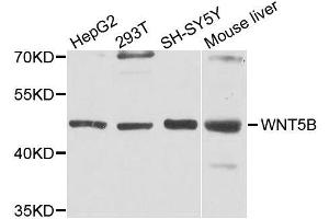 Western blot analysis of extracts of various cell lines, using WNT5B antibody. (WNT5B anticorps  (AA 120-359))