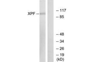 Western Blotting (WB) image for anti-Excision Repair Cross-Complementing Rodent Repair Deficiency, Complementation Group 4 (ERCC4) (AA 801-850) antibody (ABIN2889291) (ERCC4 anticorps  (AA 801-850))