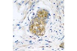 Immunohistochemical analysis of Neuroligin Y staining in human prostate formalin fixed paraffin embedded tissue section.