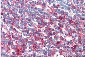 Human Tonsil (formalin-fixed, paraffin-embedded) stained with FAS antibody ABIN351542 at 10 ug/ml followed by biotinylated anti-mouse IgG secondary antibody ABIN481714, alkaline phosphatase-streptavidin and chromogen. (FAS anticorps)