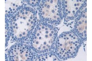 Detection of THBS1 in Mouse Testis Tissue using Polyclonal Antibody to Thrombospondin 1 (THBS1)