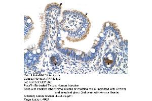 Human Intestine (RNF39 anticorps  (N-Term))