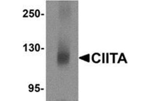 Western blot analysis of CIITA in mouse brain tissue lysate with CIITA antibody at 1 μg/ml.