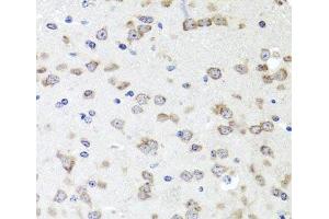 Immunohistochemistry of paraffin-embedded Mouse brain using IGFBP5 Polyclonal Antibody at dilution of 1:100 (40x lens). (IGFBP5 anticorps)