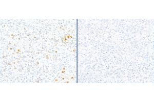 Immunohistochemistry (IHC) image for anti-gamma Histone Variant H2AX (GAMMA-H2AX) (Ser140) antibody (ABIN7449557) (gamma H2AX anticorps  (Ser140))
