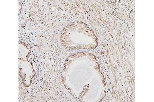 IHC analysis of CALR using anti-CALR antibody (ABIN7600329). (Calreticulin anticorps  (AA 18-323))