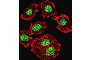 Fluorescent confocal image of  cell stained with p53 Antibody  h. (p53 anticorps  (AA 293-322))