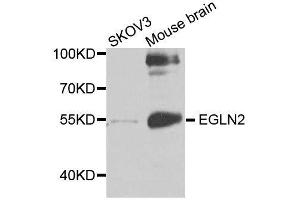 Western blot analysis of extracts of various cell lines, using EGLN2 antibody.