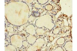 Immunohistochemistry of paraffin-embedded human thyroid tissue using ABIN7175757 at dilution of 1:100 (WDR49 anticorps  (AA 251-500))