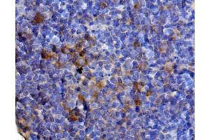 IHC analysis of Il13 using anti-Il13 antibody (ABIN7600672). (IL-13 anticorps  (AA 22-131))