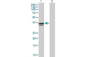 Western Blot analysis of ST3GAL2 expression in transfected 293T cell line by ST3GAL2 MaxPab polyclonal antibody. (ST3GAL2 anticorps  (AA 1-350))