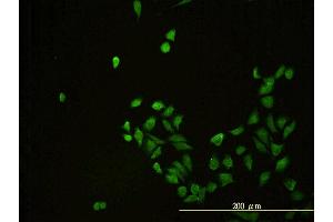 Immunofluorescence of monoclonal antibody to CD58 on HeLa cell.