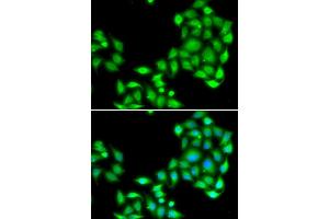 Immunofluorescence analysis of A549 cell using OGFR antibody. (OGFR anticorps)