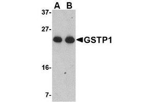 Western blot analysis of GSTP1 in Jurkat cell lysate with AP30389PU-N GSTP1 antibody at (A) 0. (GSTP1 anticorps  (Center))