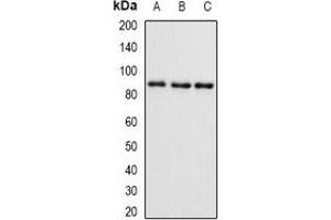 Western blot analysis of SMYD4 expression in mouse brain (A), mouse ovary (B), rat kidney (C) whole cell lysates. (SMYD4 anticorps)