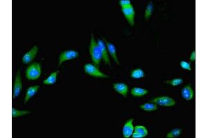 Immunofluorescent analysis of Hela cells using ABIN7174670 at dilution of 1:100 and Alexa Fluor 488-congugated AffiniPure Goat Anti-Rabbit IgG(H+L)