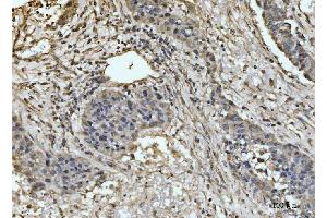 IHC analysis of EXOSC8 using anti-EXOSC8 antibody (ABIN7601850). (EXOSC8 anticorps  (AA 49-216))
