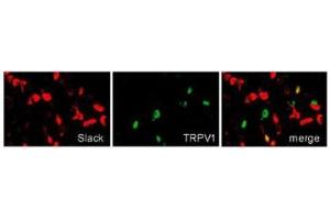 Double-labeling immunostaining of Slack (red) and TRPV1 (green) in DRGs.