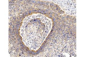 IHC analysis of RPL8 using anti-RPL8 antibody (ABIN7601179).