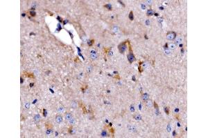 IHC analysis of ATG9A using anti-ATG9A antibody (ABIN7600676). (ATG9A anticorps  (AA 22-169))