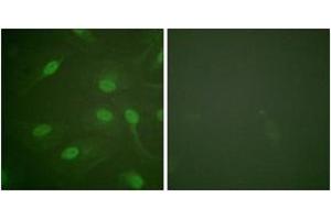 Immunofluorescence analysis of HeLa cells, using Chk1 (Phospho-Ser301) Antibody.