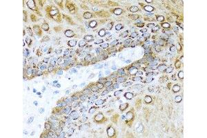 Immunohistochemistry of paraffin-embedded Human esophagus using S100A7 Polyclonal Antibody at dilution of 1:100 (40x lens). (S100A7 anticorps)