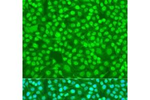 Immunofluorescence analysis of U2OS cells using SFRS9 Polyclonal Antibody at dilution of 1:100. (SFRS9 anticorps)
