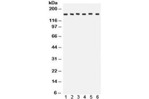 Western blot testing of 1) rat brain, 2) rat liver, 3) human HeLa, 4) CEM, 5) A549 and 6) MCF7 lysate with ROCK2 antibody. (ROCK2 anticorps  (AA 652-923))