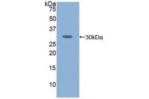 Detection of Recombinant ATXN1, Human using Polyclonal Antibody to Ataxin 1 (ATXN1) (Ataxin 1 anticorps  (AA 569-807))