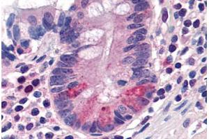 Human Small Intestine, Paneth Cells (formalin-fixed, paraffin-embedded) stained with SLC15A1 antibody ABIN290274 at 20 ug/ml followed by biotinylated goat anti-rabbit IgG secondary antibody ABIN481713, alkaline phosphatase-streptavidin and chromogen. (SLC15A1 anticorps  (C-Term))