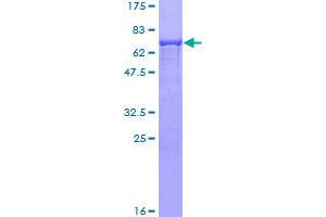 Image no. 1 for Homer Homolog 2 (HOMER2) (AA 1-343) protein (GST tag) (ABIN1306894)