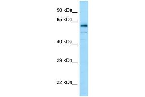 Western Blotting (WB) image for anti-Dihydropyrimidinase-Like 4 (DPYSL4) (C-Term) antibody (ABIN2790103) (DPYSL4 anticorps  (C-Term))
